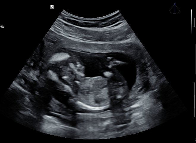 2D scan